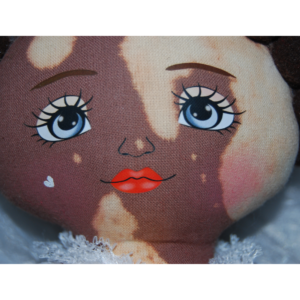 Boneca Negra com vitiligo
